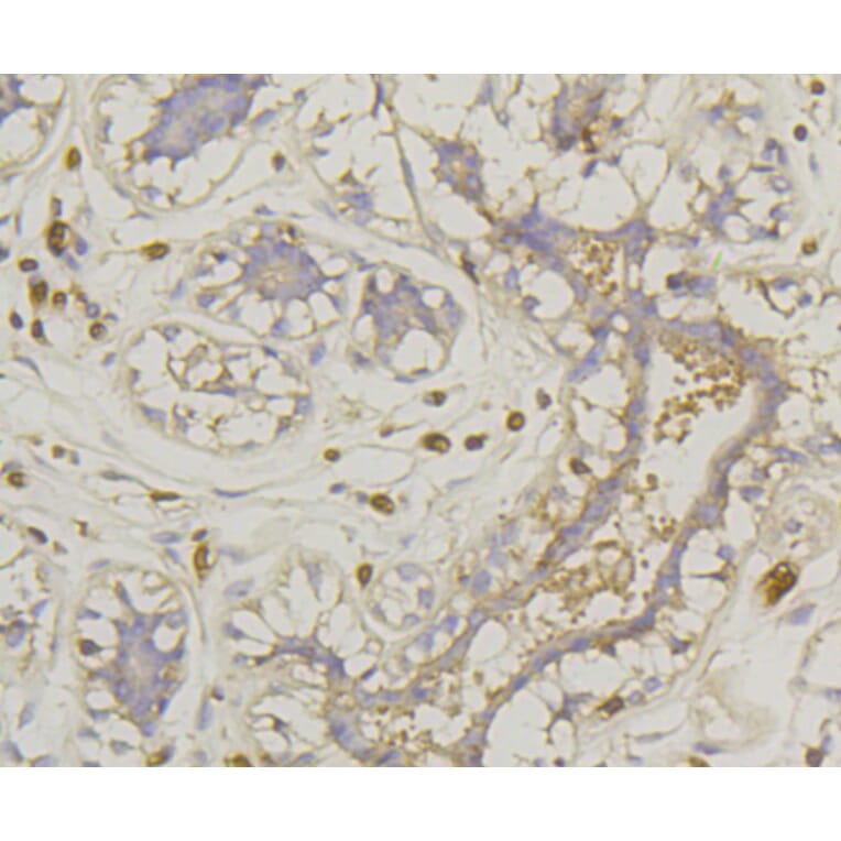 Immunohistochemistry - Anti-SLC2A1 Antibody (A11170) - Antibodies.com