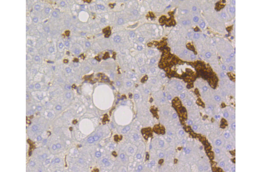 Immunohistochemistry - Anti-SLC2A1 Antibody (A11170) - Antibodies.com