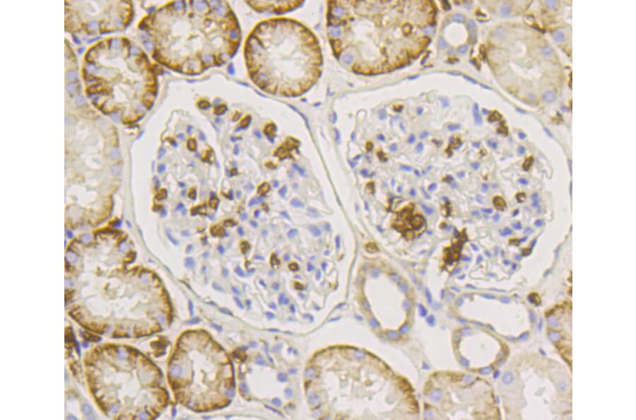 Immunohistochemistry - Anti-SLC2A1 Antibody (A11170) - Antibodies.com