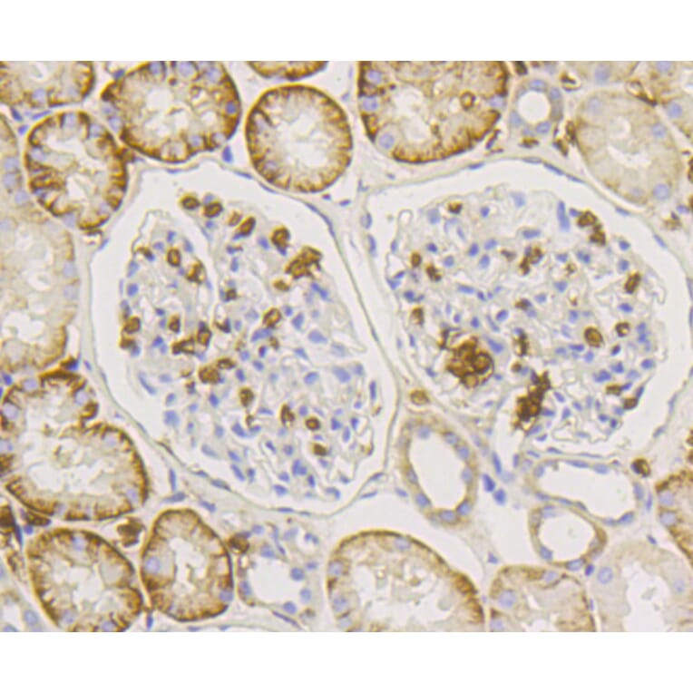 Immunohistochemistry - Anti-SLC2A1 Antibody (A11170) - Antibodies.com