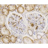 Immunohistochemistry - Anti-SLC2A1 Antibody (A11170) - Antibodies.com