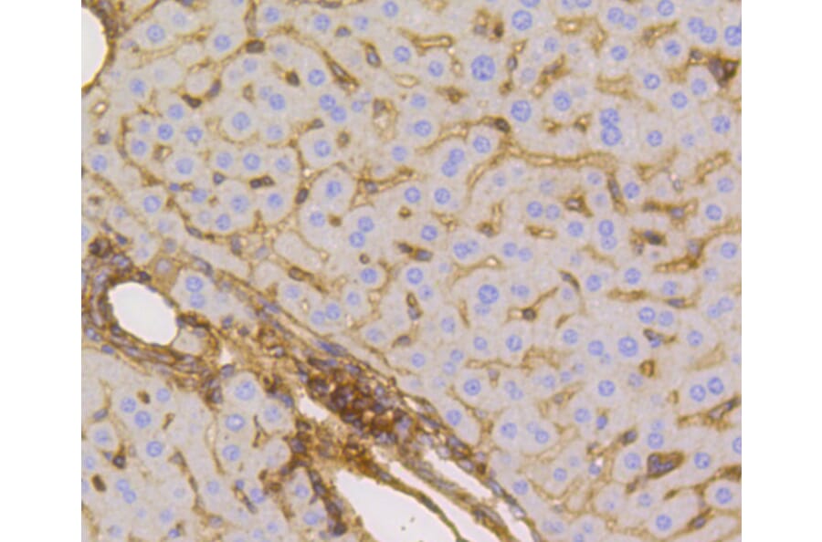 Immunohistochemistry - Anti-SLC2A1 Antibody (A11170) - Antibodies.com