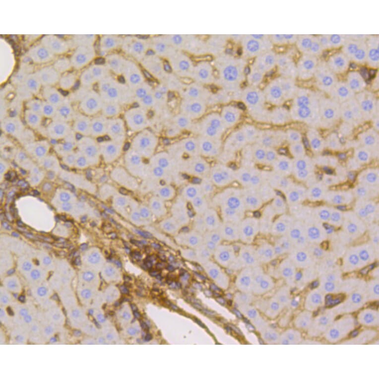 Immunohistochemistry - Anti-SLC2A1 Antibody (A11170) - Antibodies.com