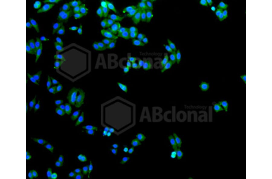 Immunofluorescence - Anti-SLC2A1 Antibody (A11170) - Antibodies.com