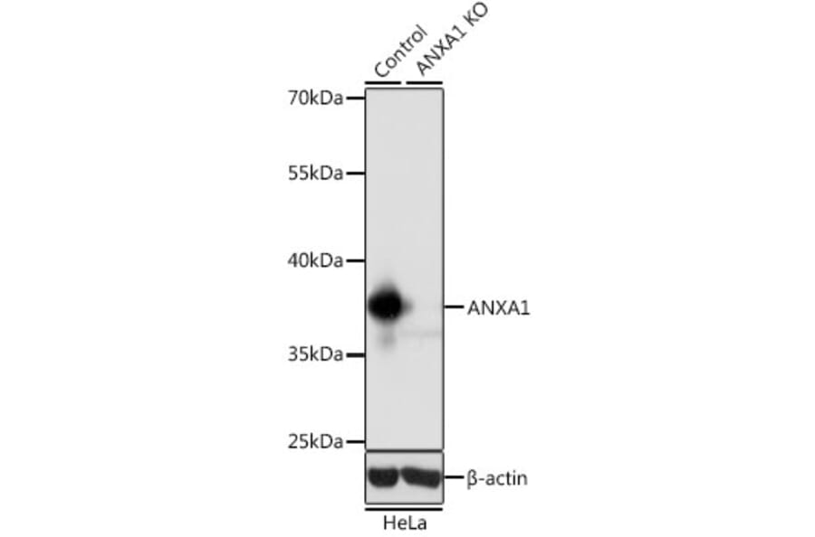 Western Blot - Anti-Annexin A1/ANXA1 Antibody (A13250) - Antibodies.com
