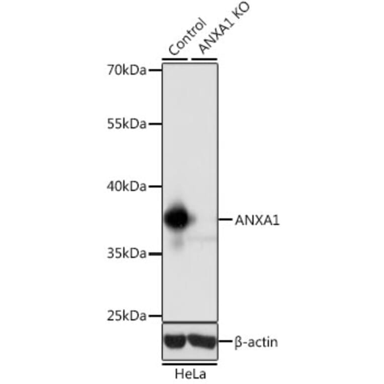 Western Blot - Anti-Annexin A1/ANXA1 Antibody (A13250) - Antibodies.com