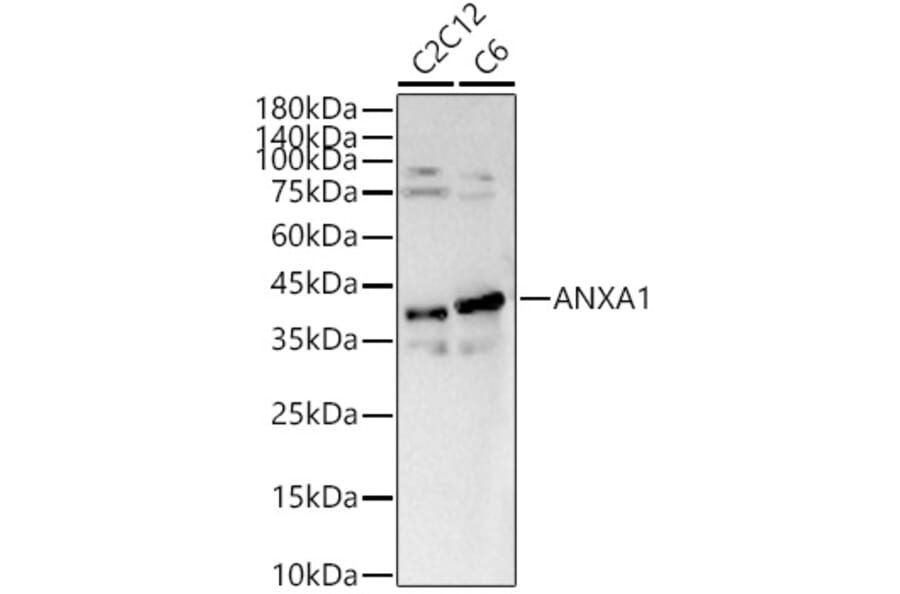 Western Blot - Anti-Annexin A1/ANXA1 Antibody (A13250) - Antibodies.com