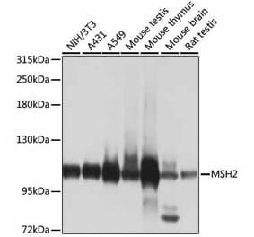 Western Blot - Anti-MSH2 Antibody (A1121) - Antibodies.com
