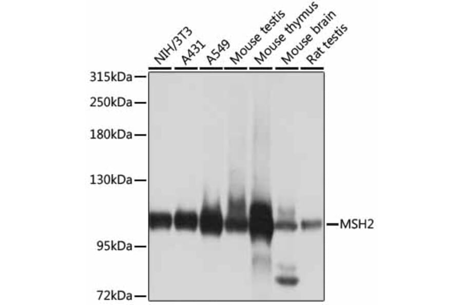 Western Blot - Anti-MSH2 Antibody (A1121) - Antibodies.com