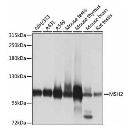 Western Blot - Anti-MSH2 Antibody (A13256) - Antibodies.com