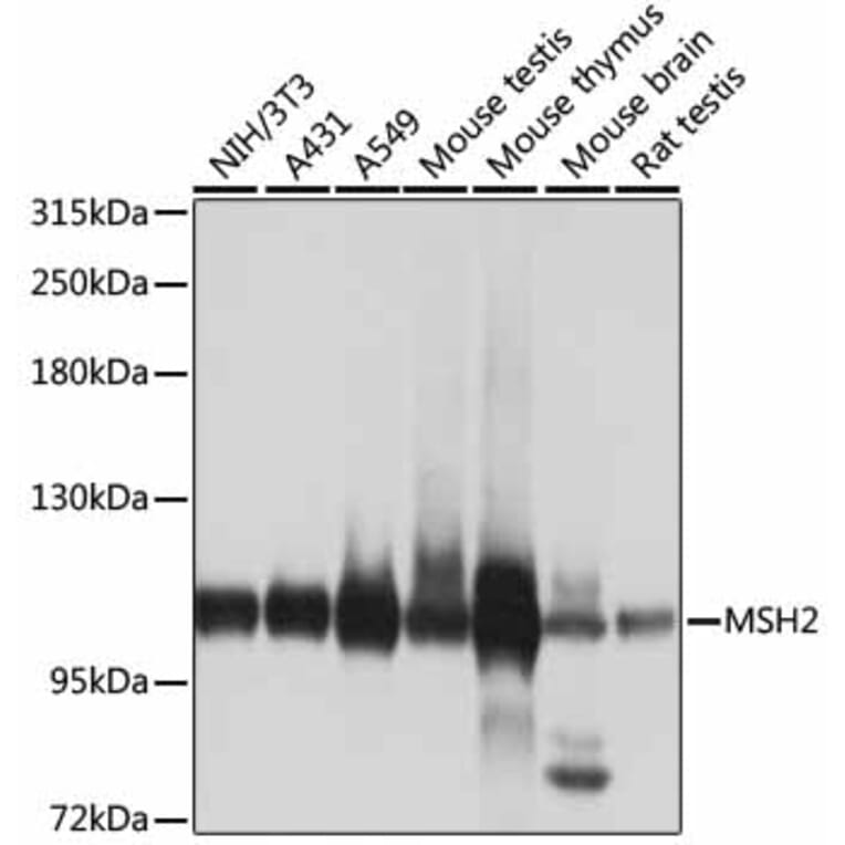 Western Blot - Anti-MSH2 Antibody (A1121) - Antibodies.com