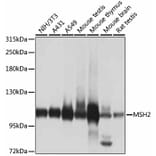 Western Blot - Anti-MSH2 Antibody (A1121) - Antibodies.com