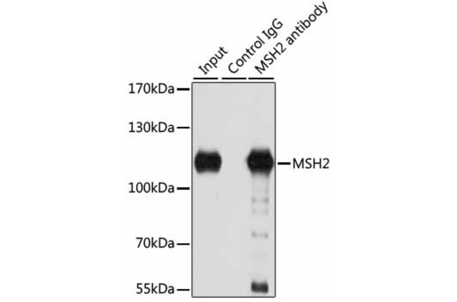 Immunoprecipitation - Anti-MSH2 Antibody (A1121) - Antibodies.com