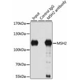 Immunoprecipitation - Anti-MSH2 Antibody (A1121) - Antibodies.com