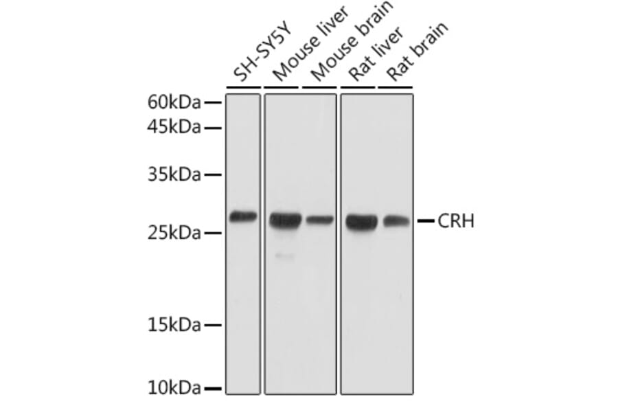 Western Blot - Anti-CRF Antibody (A13257) - Antibodies.com
