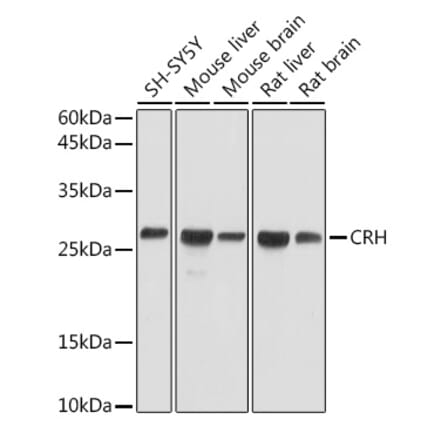 Western Blot - Anti-CRF Antibody (A13257) - Antibodies.com