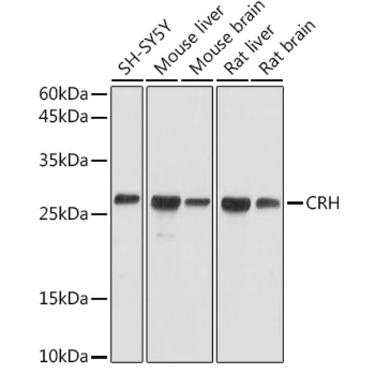 Western Blot - Anti-CRF Antibody (A13257) - Antibodies.com