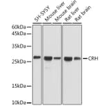 Western Blot - Anti-CRF Antibody (A13257) - Antibodies.com