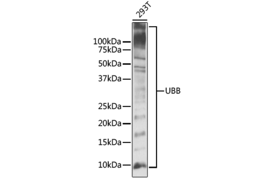 Western Blot - Anti-UBB Antibody (A11227) - Antibodies.com