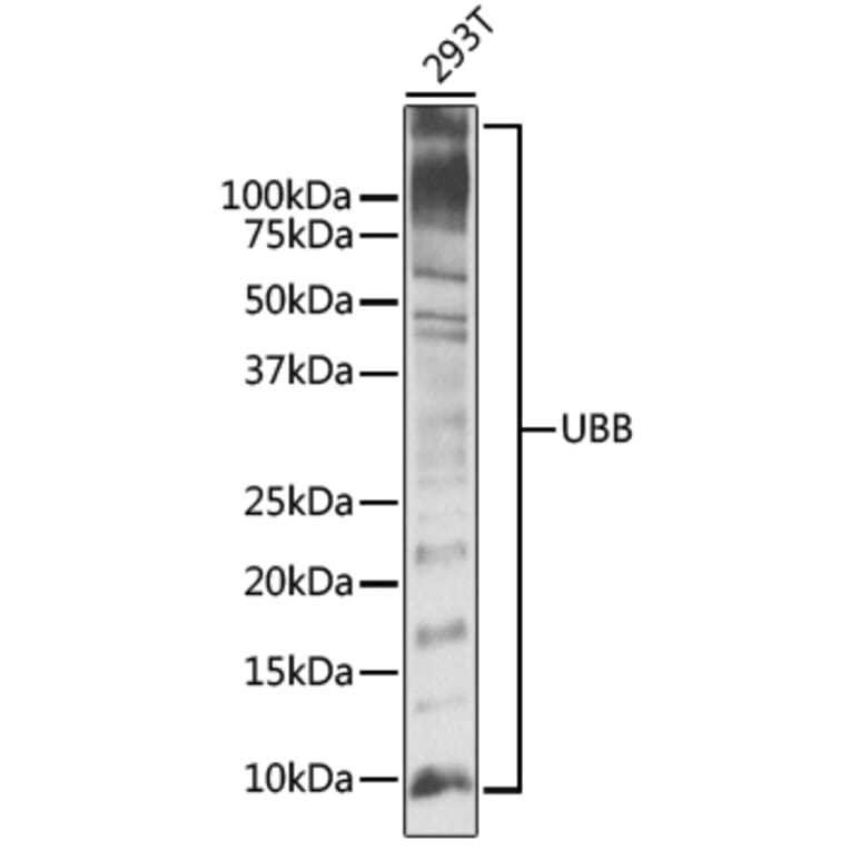 Western Blot - Anti-UBB Antibody (A11227) - Antibodies.com