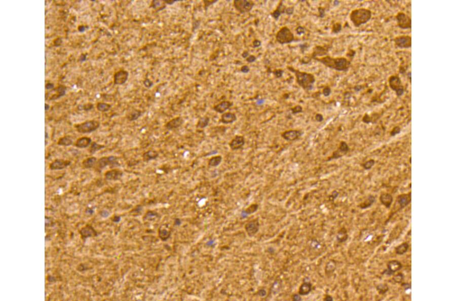 Immunohistochemistry - Anti-UBB Antibody (A11227) - Antibodies.com