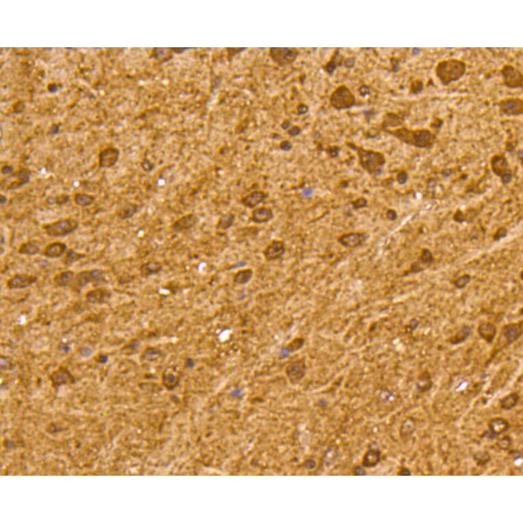 Immunohistochemistry - Anti-UBB Antibody (A11227) - Antibodies.com