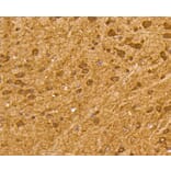 Immunohistochemistry - Anti-UBB Antibody (A11227) - Antibodies.com
