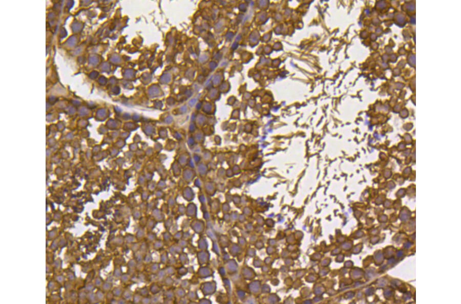 Immunohistochemistry - Anti-UBB Antibody (A11227) - Antibodies.com
