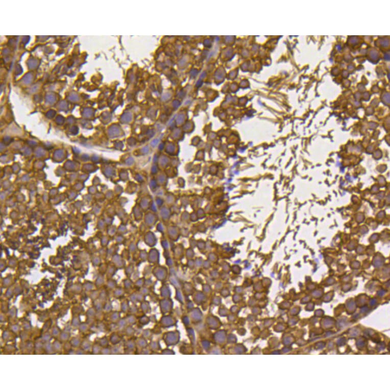 Immunohistochemistry - Anti-UBB Antibody (A11227) - Antibodies.com