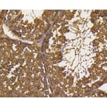 Immunohistochemistry - Anti-UBB Antibody (A11227) - Antibodies.com