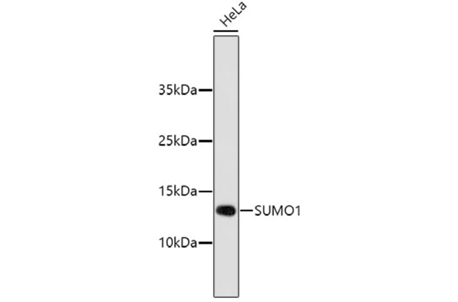 Western Blot - Anti-SUMO1 Antibody (A11230) - Antibodies.com