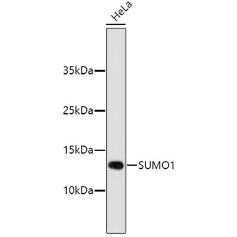 Western Blot - Anti-SUMO1 Antibody (A11230) - Antibodies.com