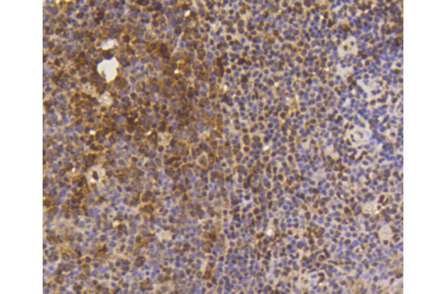 Immunohistochemistry - Anti-SUMO1 Antibody (A11230) - Antibodies.com