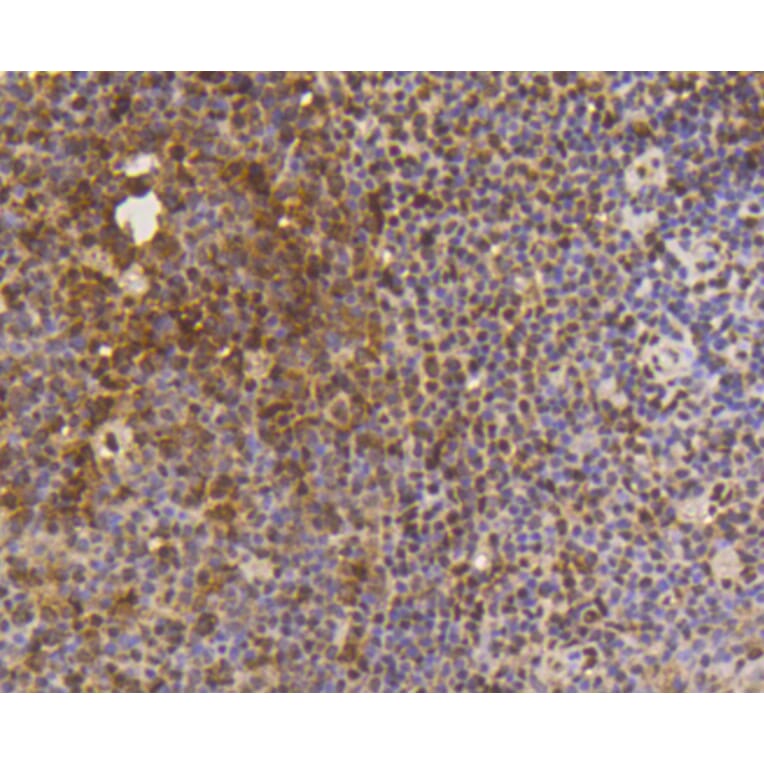 Immunohistochemistry - Anti-SUMO1 Antibody (A11230) - Antibodies.com
