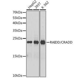 Western Blot - Anti-RAIDD Antibody (A13263) - Antibodies.com