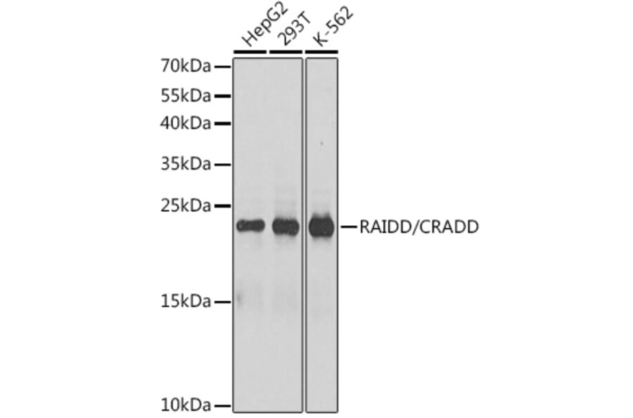 Western Blot - Anti-RAIDD Antibody (A13263) - Antibodies.com