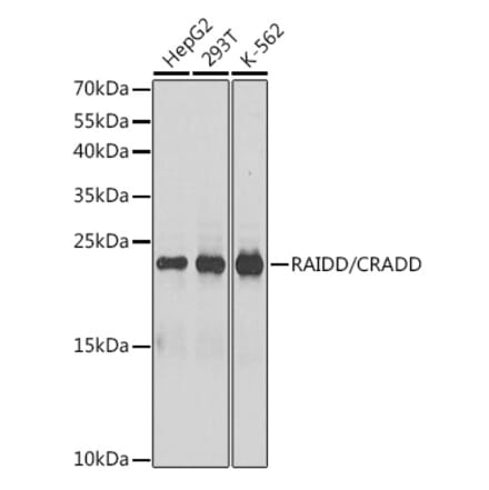 Western Blot - Anti-RAIDD Antibody (A13263) - Antibodies.com