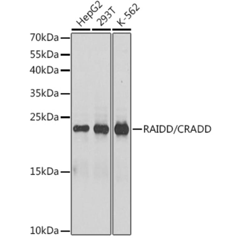 Western Blot - Anti-RAIDD Antibody (A13263) - Antibodies.com