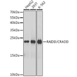 Western Blot - Anti-RAIDD Antibody (A13263) - Antibodies.com