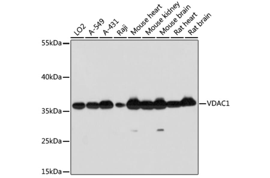 Western Blot - Anti-VDAC1 Antibody (A11242) - Antibodies.com