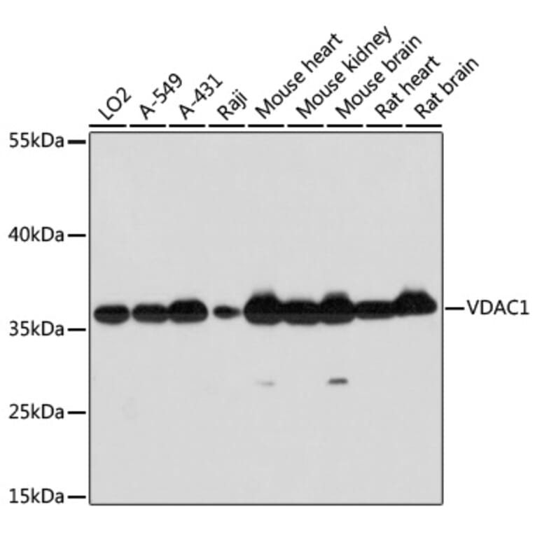 Western Blot - Anti-VDAC1 Antibody (A11242) - Antibodies.com