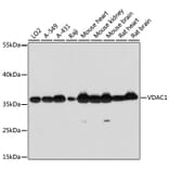 Western Blot - Anti-VDAC1 Antibody (A11242) - Antibodies.com