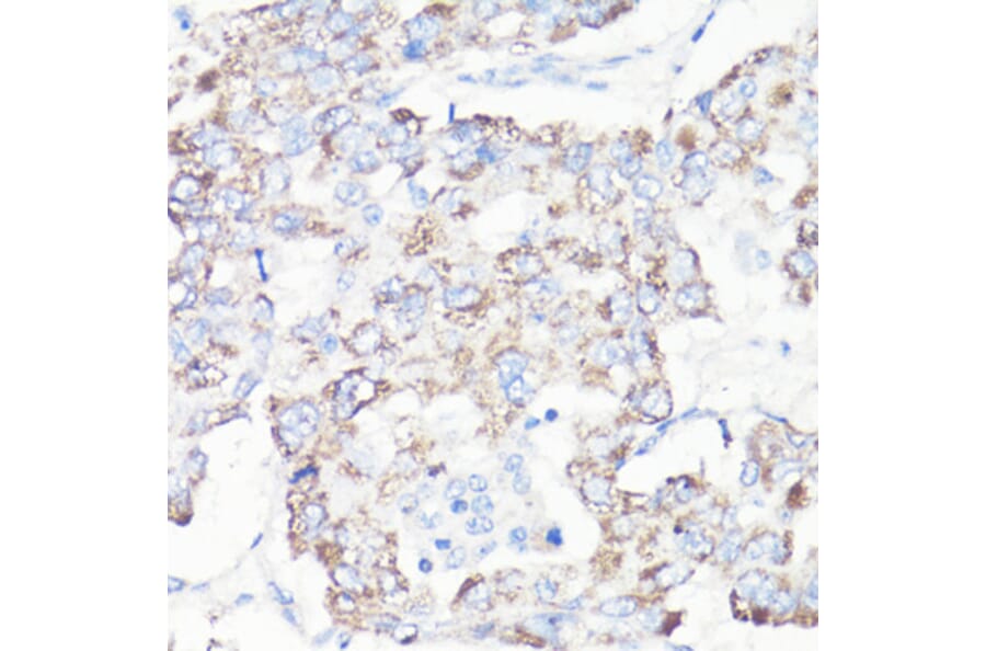 Immunohistochemistry - Anti-VDAC1 Antibody (A11242) - Antibodies.com