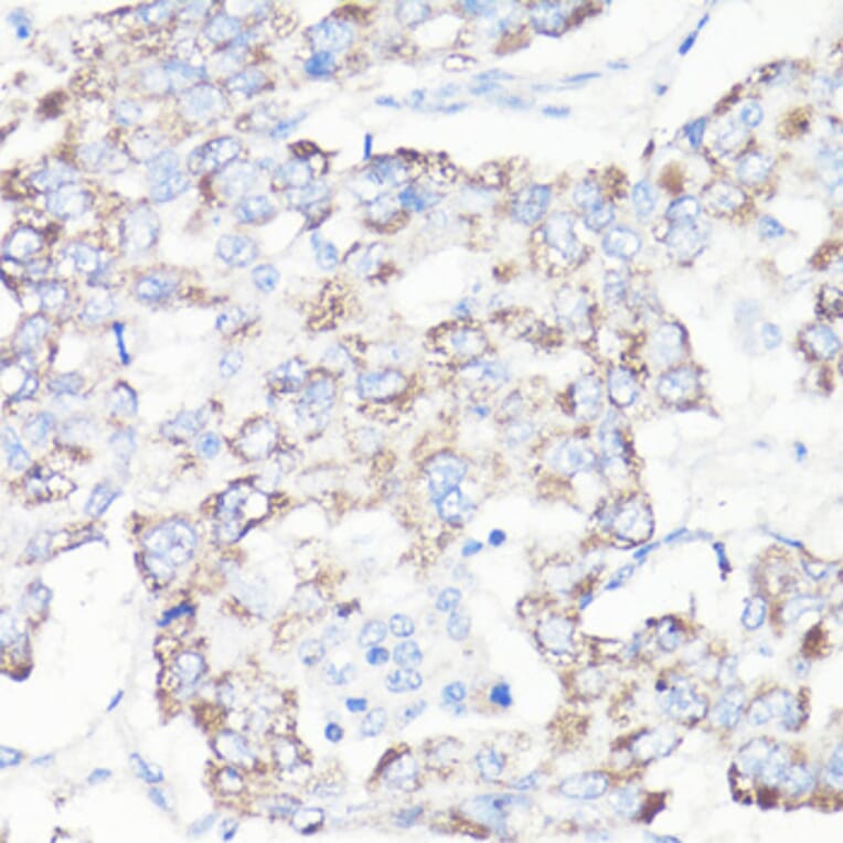 Immunohistochemistry - Anti-VDAC1 Antibody (A11242) - Antibodies.com