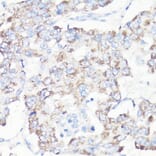 Immunohistochemistry - Anti-VDAC1 Antibody (A11242) - Antibodies.com