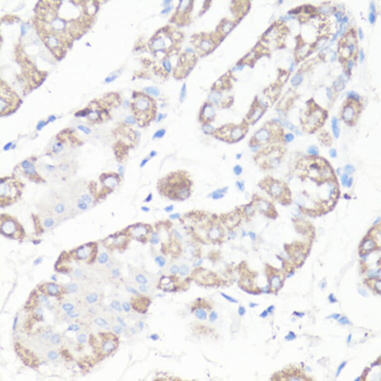 Immunohistochemistry - Anti-VDAC1 Antibody (A11242) - Antibodies.com