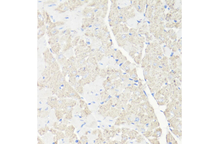 Immunohistochemistry - Anti-VDAC1 Antibody (A11242) - Antibodies.com