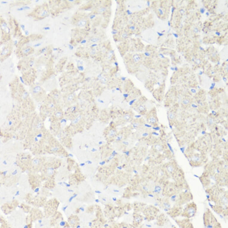 Immunohistochemistry - Anti-VDAC1 Antibody (A11242) - Antibodies.com