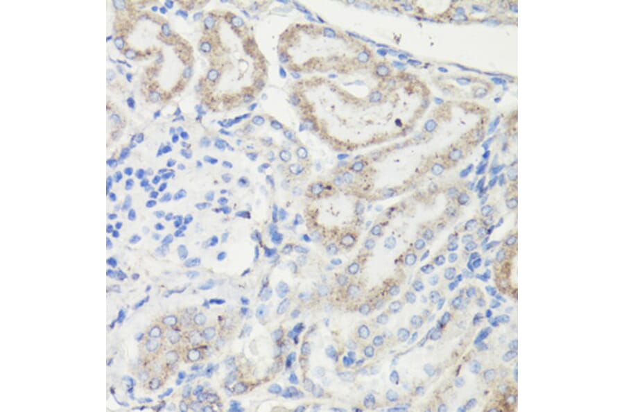 Immunohistochemistry - Anti-VDAC1 Antibody (A11242) - Antibodies.com