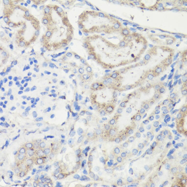Immunohistochemistry - Anti-VDAC1 Antibody (A11242) - Antibodies.com